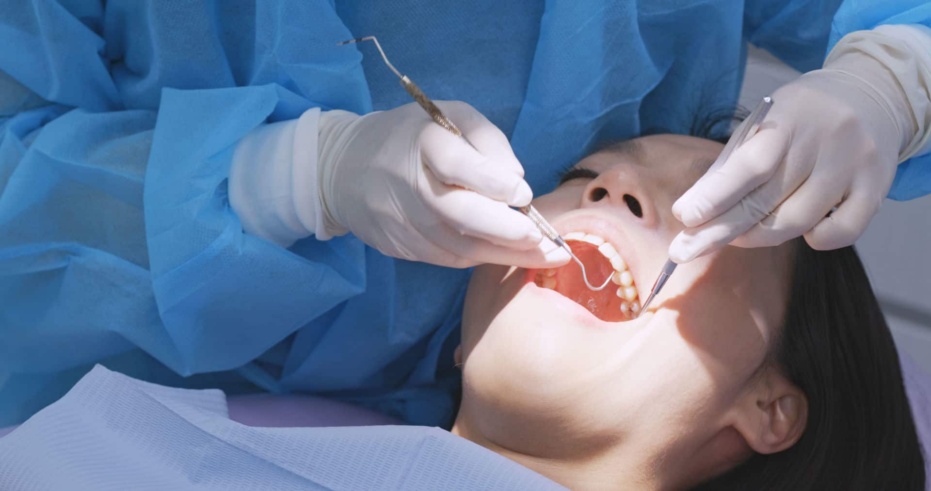 Root Canal Treatment » Raffles Dental » 24hour Emergency Service