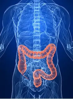Colonoscopy - Scanning large intestine for abnormalities