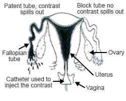 Illustration Fertility Tests and Treatments