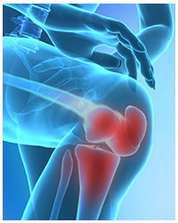 Knee pain surrounding the joints