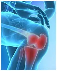 Knee pain surrounding the joints