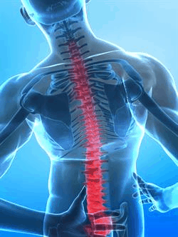 Back Pain Raffles Medical Group