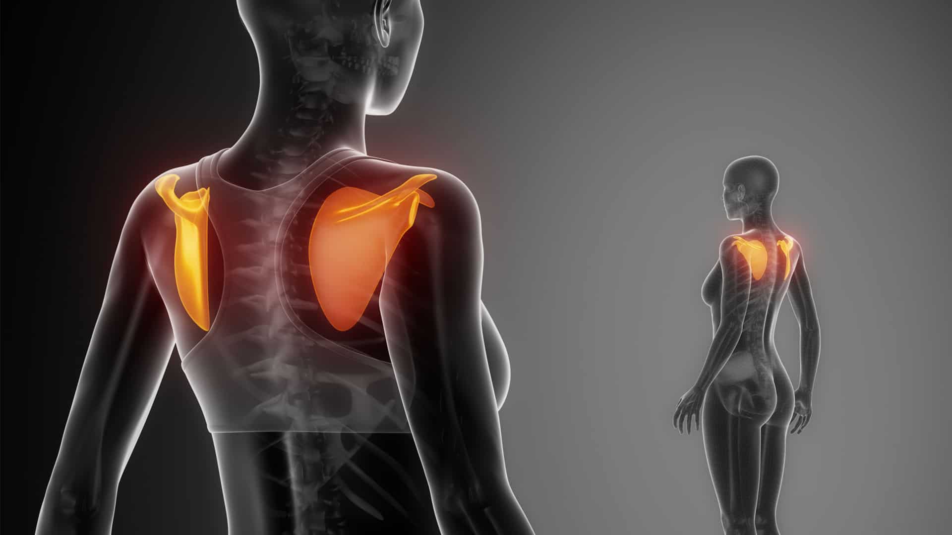 Understanding Shoulder Pain » Raffles Orthopaedic Centre, Singapore