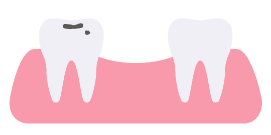 Tooth decay and trauma