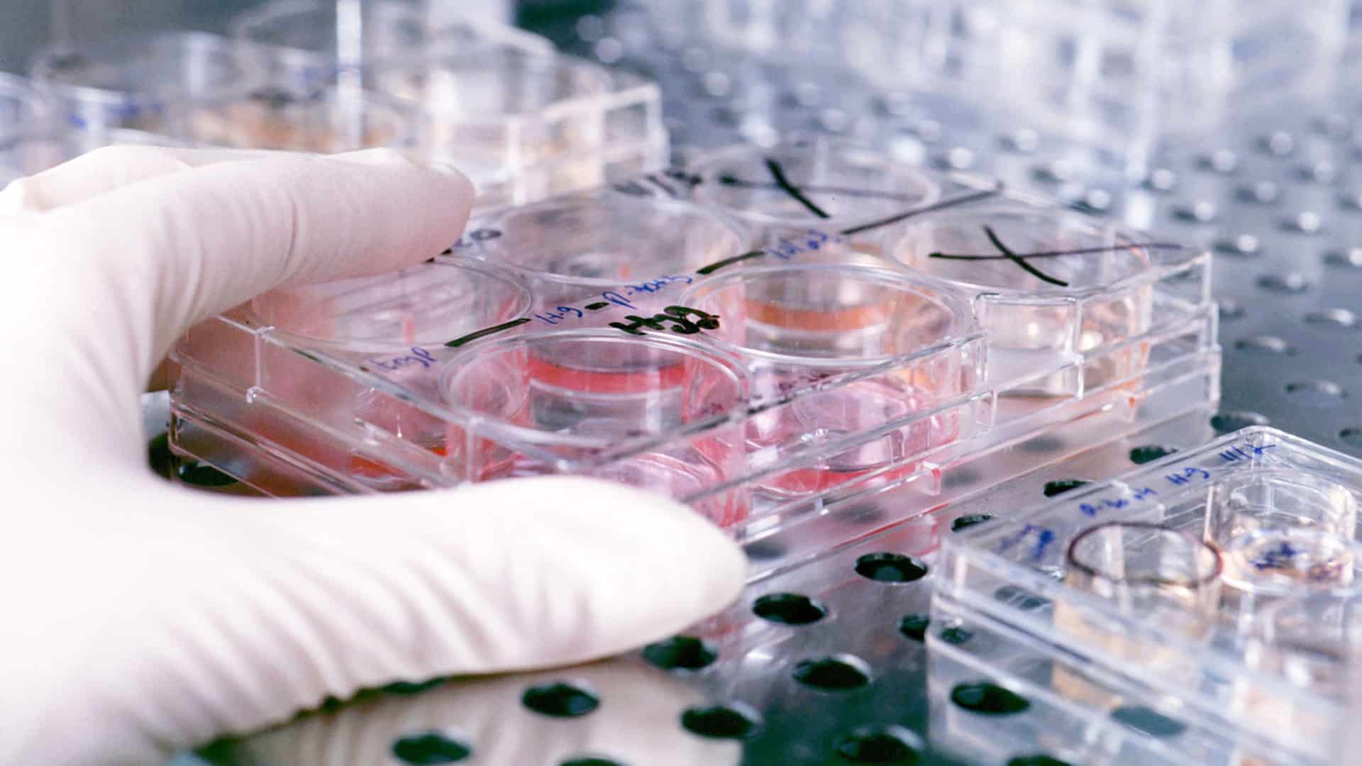 Lab samples being tested and screening