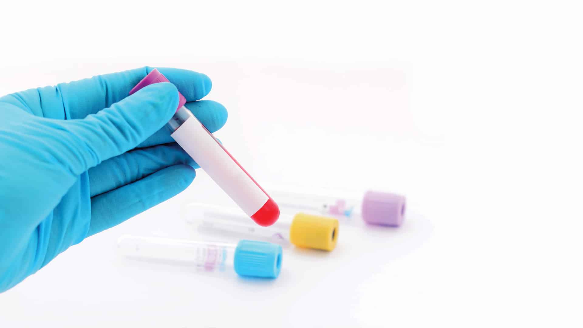 rm-bg-sash Raffles Medical - Swab and Send Home initiative for COVID-9 testing