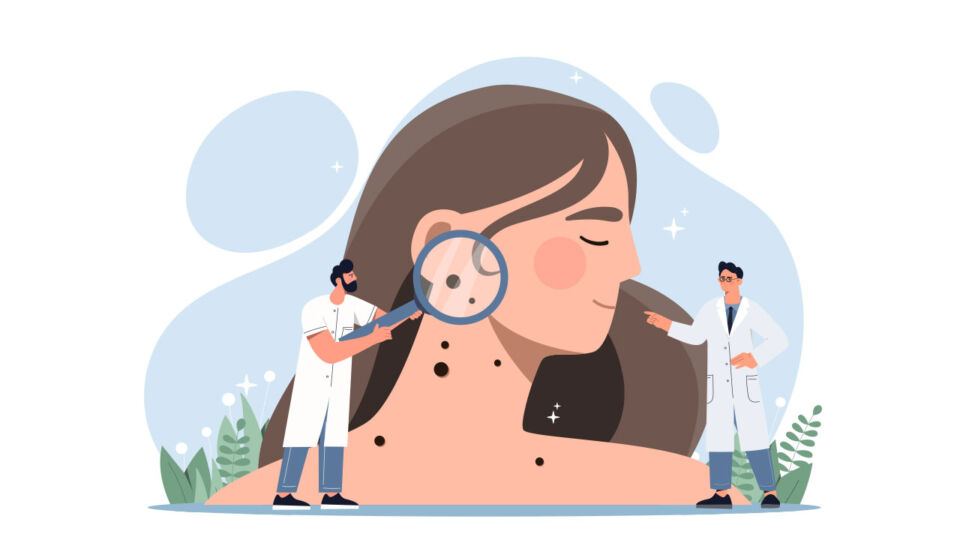 About Skin Cancer - Singapore