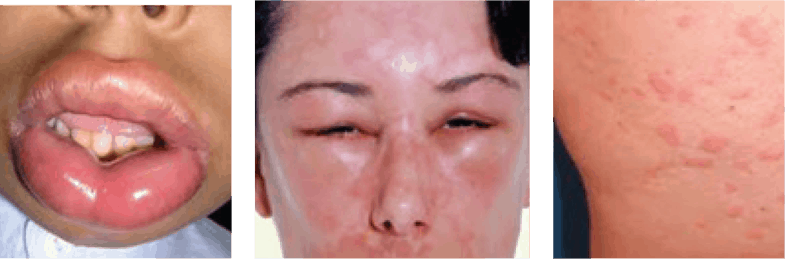 covid vaccine sore throat side effect