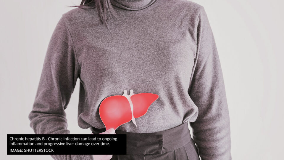 Chronic hepatitis B Chronic infection can lead to ongoing inflammation and progressive liver damage over time