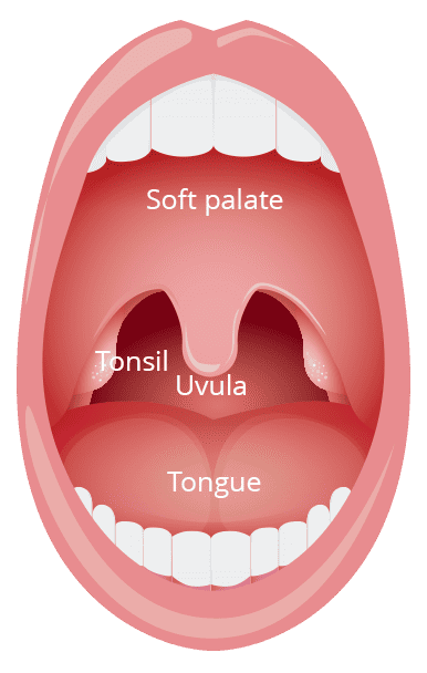 Normal tonsils without inflammation