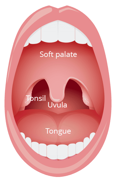 Normal tonsils without inflammation Normal tonsils without inflammation