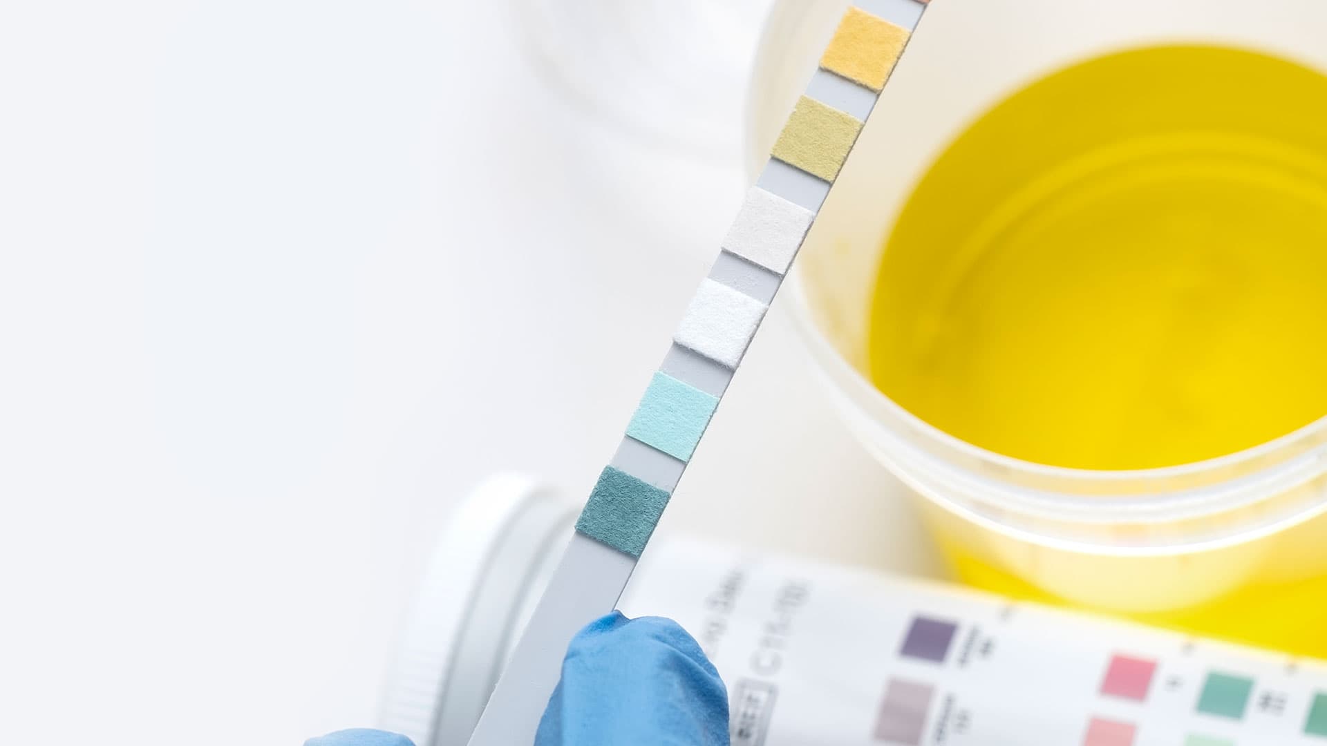 What do the urine colours really mean?
