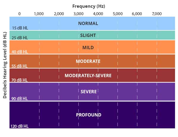 Clinicians measure sound intensity in dB HL (decibels Hearing Level) - Chart Overview