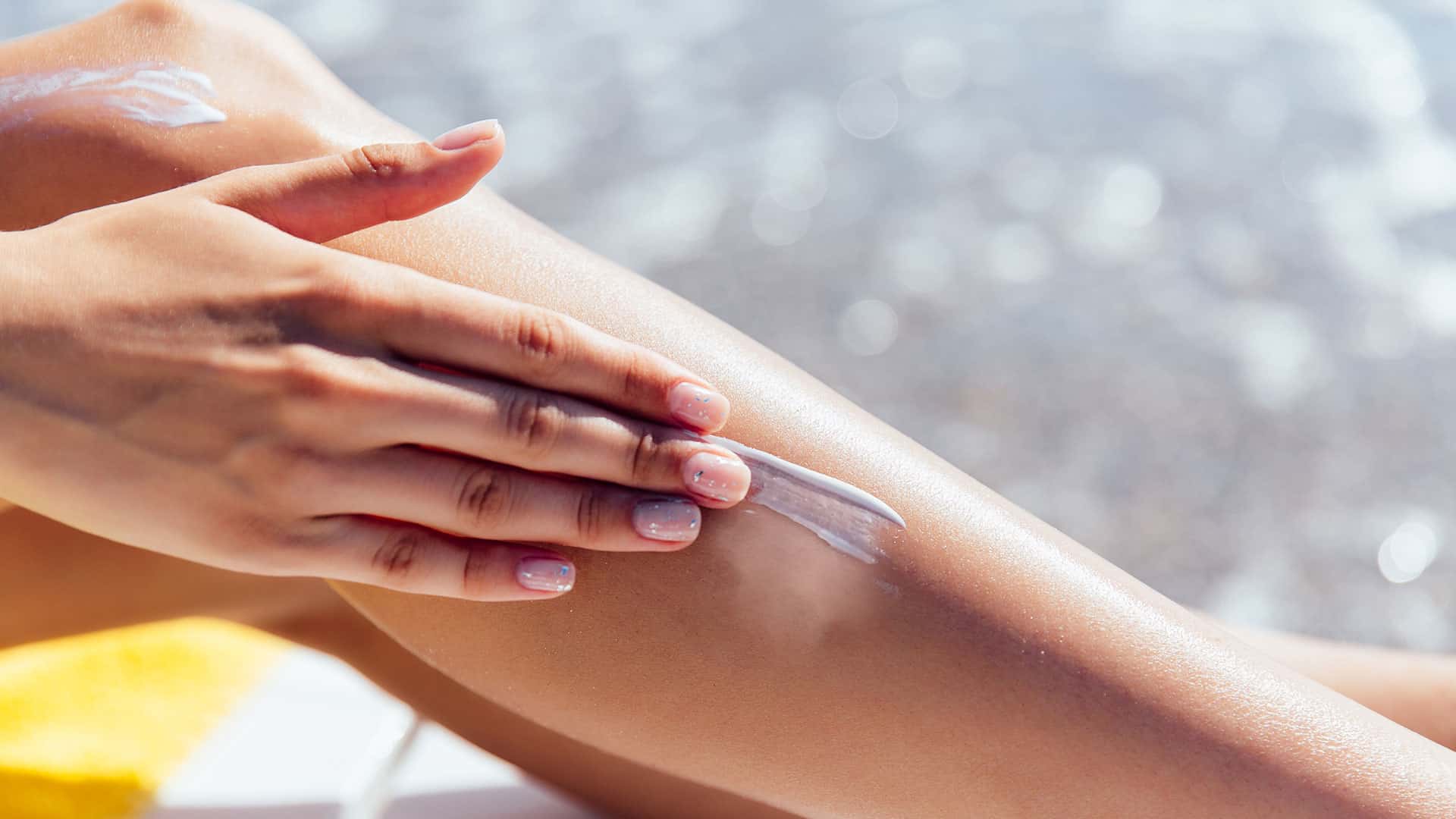 Use of sunscreen on the affected area - vitiligo Use of sunscreen on the affected area - vitiligo