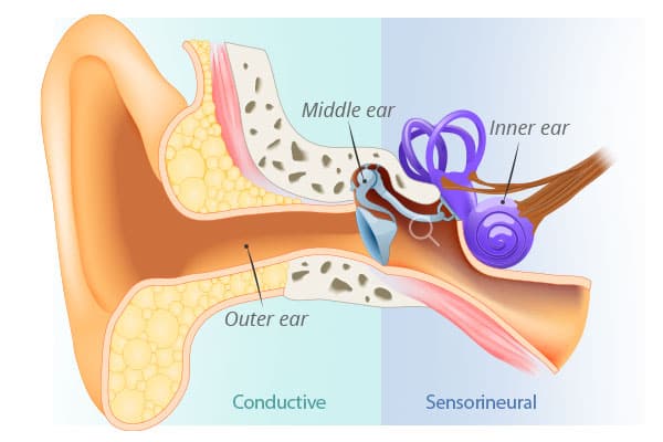 conductive and sensorineural hearing loss anatomy