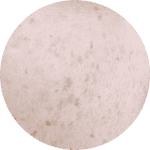 Freckles, age spots, sun spots etc