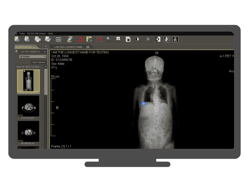 Step 5 - After successful login, the DICOM view will appear and preload all the images. Step 5 - After successful login, the DICOM view will appear and preload all the images.