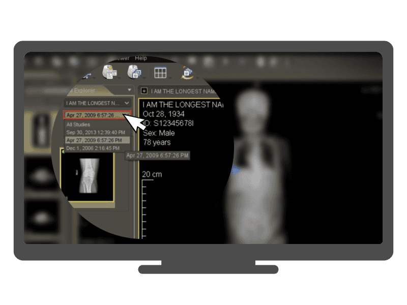 DICOM viewer can filter the images based on the date of record DICOM viewer can filter the images based on the date of record