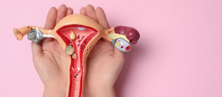 Myth: I heard having a cervical screening test is painful