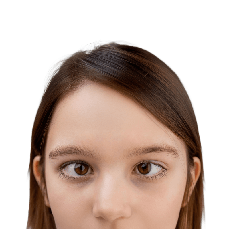 Illustration of crossed eyes (strabismus), showing a child with eye misalignment and explaining that the condition can affect depth perception if left untreated.