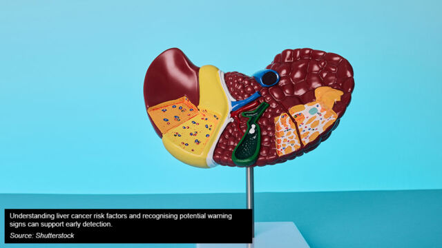 Anatomical model of the human liver illustrating its internal structures, used in an educational article about liver cancer.