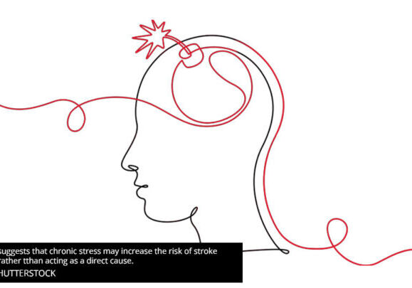 Stroke and stress - Reresearch suggests that chronic stress may increase the risk of stroke indirectly rather than acting as a direct cause.