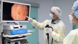 colonscopy screening with artificial intelligence